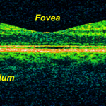 Retina-OCT800